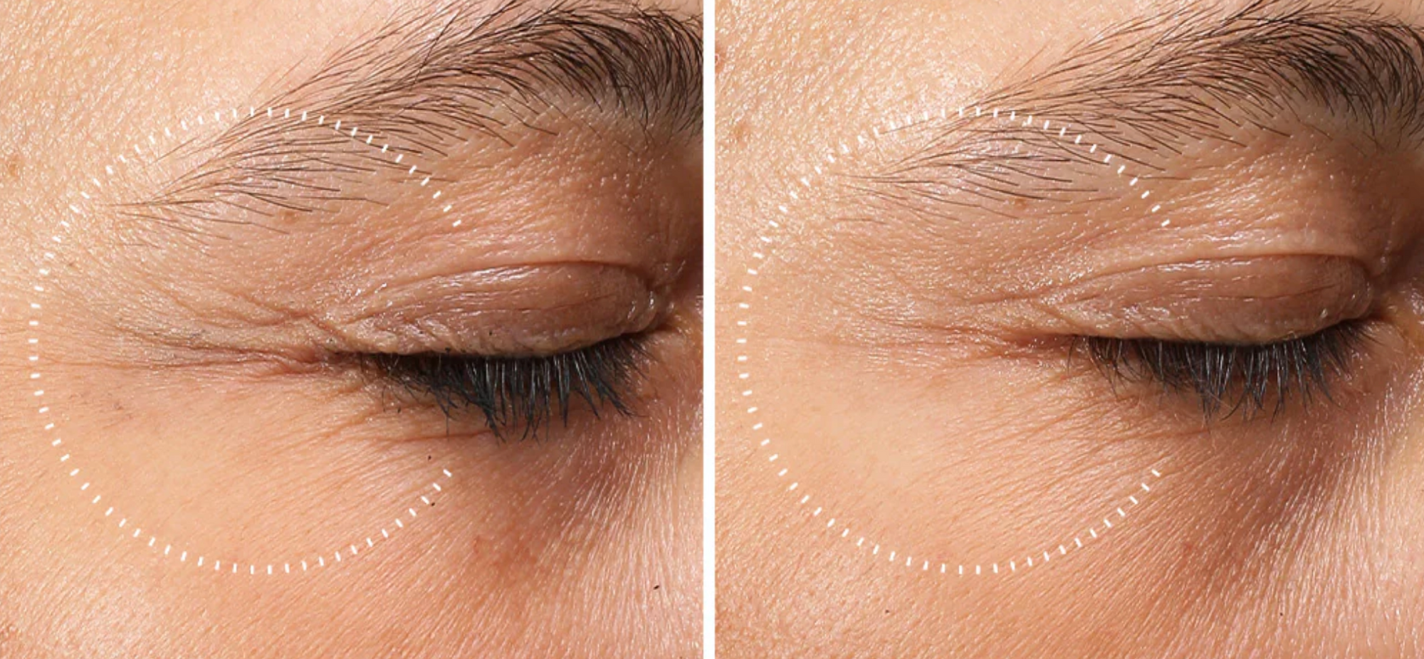 Descubre los beneficios del retinal en el cuidado de la piel