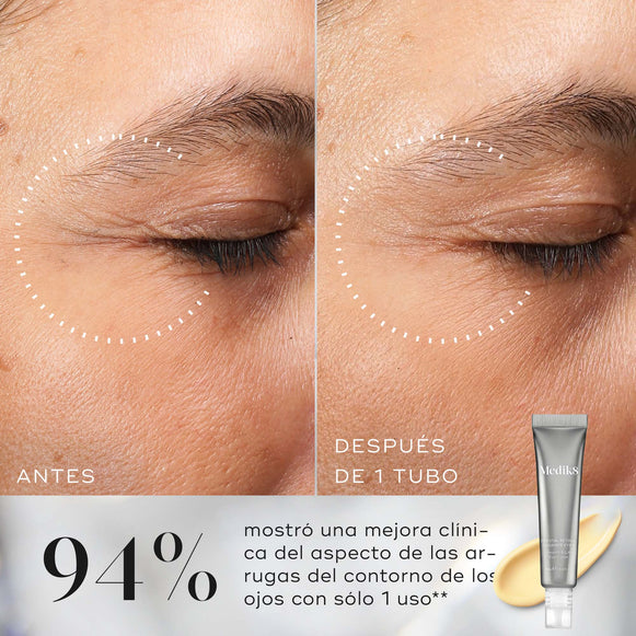 Primer plano comparativo de las arrugas de los ojos antes y después de utilizar Medik8 Crystal Retinal Ceramide Eye, que muestra una reducción visible de las líneas.-hover-14
