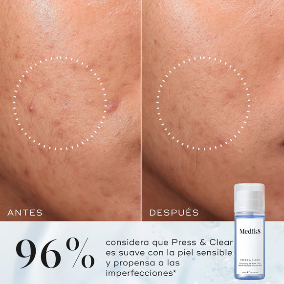 Press & Clear™, tónico ideal para pieles sensibles y propensas a imperfecciones-hover-22