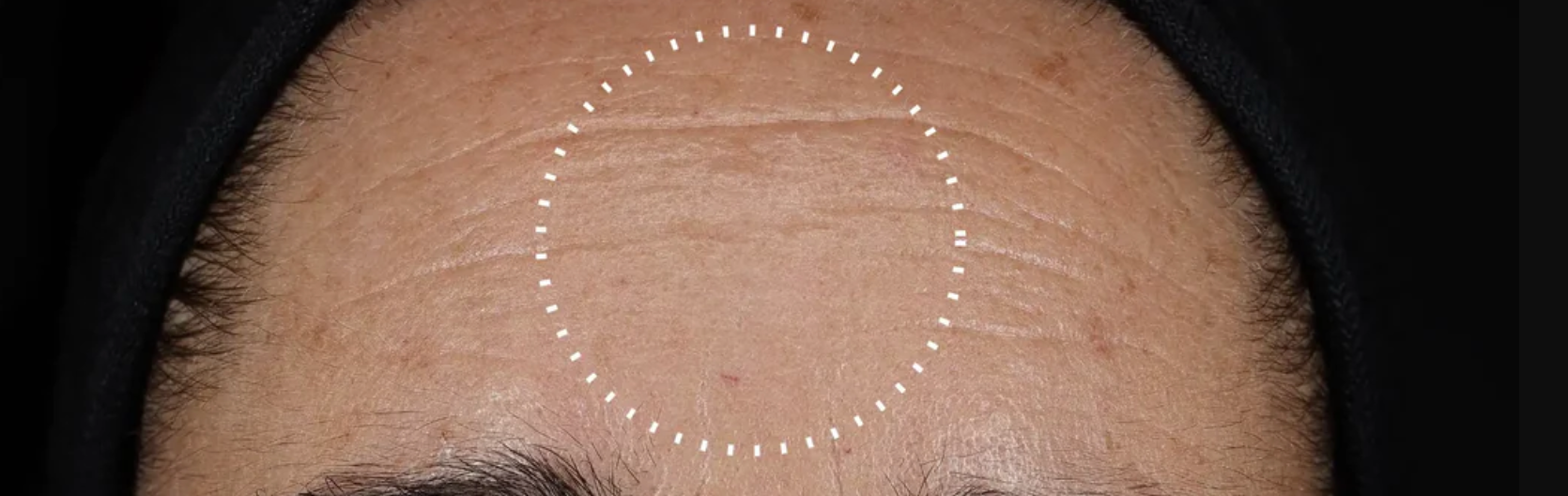 La Unión Europea prohíbe el retinol tal como lo conocíamos: ¡Conoce las alternativas de Medik8!