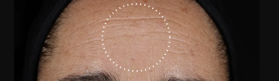 suero más potente de retinaldehído de España