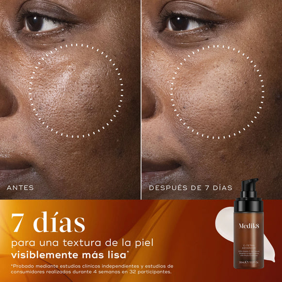 Primer plano antes y después de la piel de una participante durante 7 días, que muestra una textura de la piel visiblemente más suave y un aspecto refinado.-hover-76