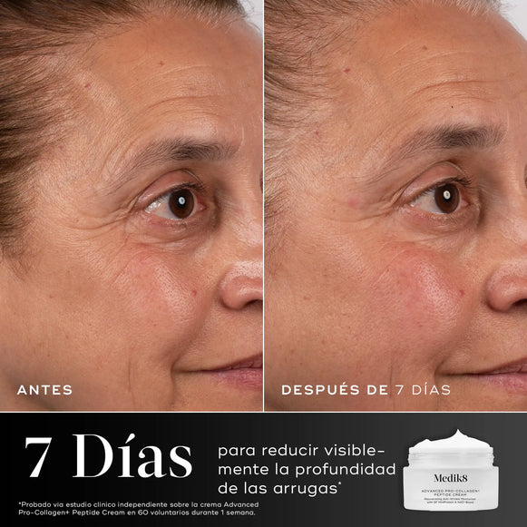 Antes y después de 7 días usando Medik8 Advanced Pro-Collagen+ Peptide Cream, reducción visible de arrugas en la piel-hover-80