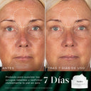 Imagen dividida que muestra los resultados «ANTES» y «DESPUÉS DE 7 DÍAS DE USO» de un producto para el cuidado de la piel en el rostro de una persona, centrándose específicamente en la frente y el contorno de los ojos. El lado izquierdo, etiquetado como «ANTES», muestra arrugas y líneas visibles. El lado derecho, etiquetado como «DESPUÉS DE 7 DÍAS DE USO», muestra una notable reducción en la apariencia de estas arrugas. En la esquina inferior derecha se ve un frasco de crema blanca con el texto «7 días».