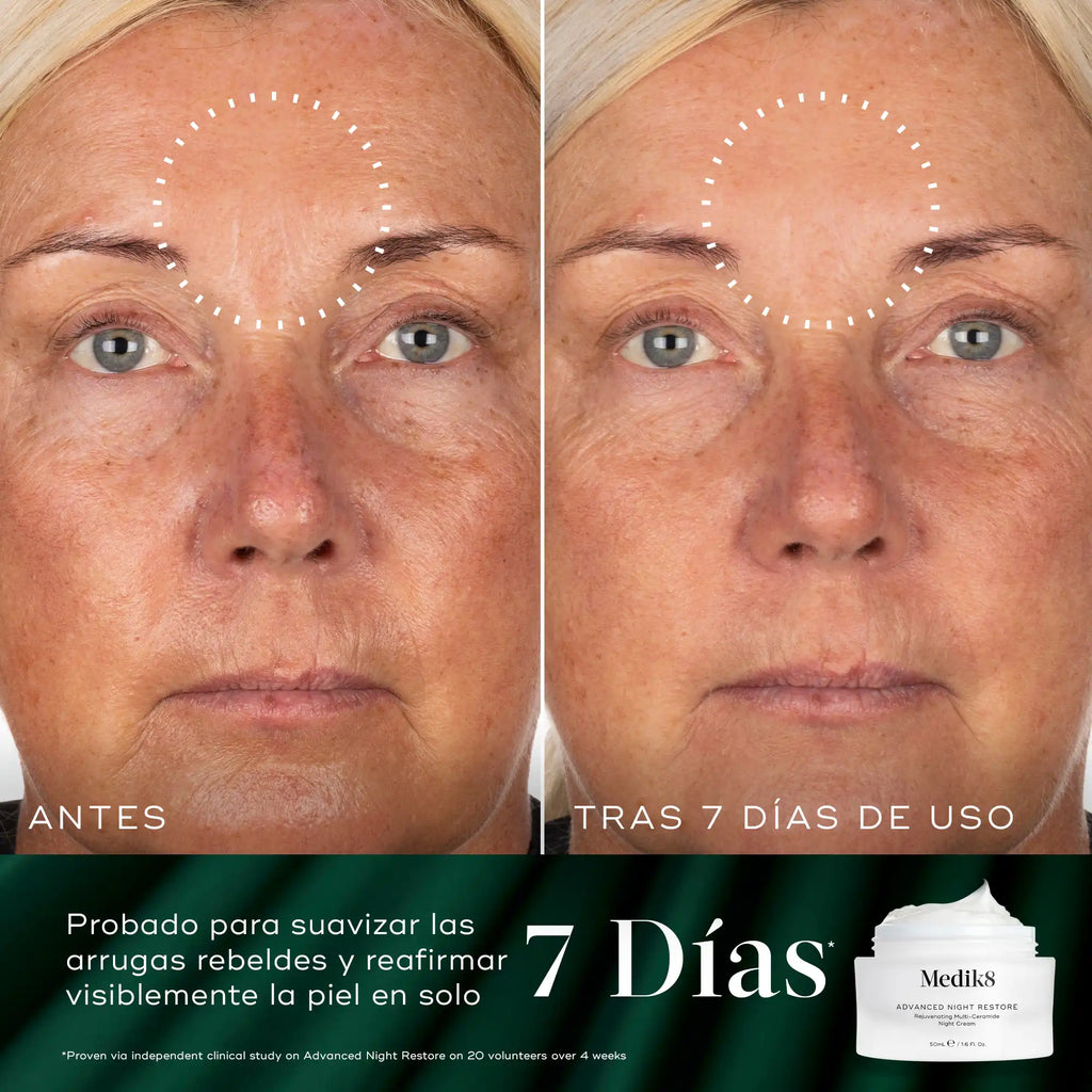 Imagen dividida que muestra los resultados «ANTES» y «DESPUÉS DE 7 DÍAS DE USO» de un producto para el cuidado de la piel en el rostro de una persona, centrándose específicamente en la frente y el contorno de los ojos. El lado izquierdo, etiquetado como «ANTES», muestra arrugas y líneas visibles. El lado derecho, etiquetado como «DESPUÉS DE 7 DÍAS DE USO», muestra una notable reducción en la apariencia de estas arrugas. En la esquina inferior derecha se ve un frasco de crema blanca con el texto «7 días».