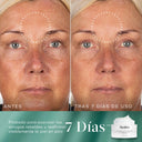 Imagen dividida que muestra los resultados «antes» y «DESPUÉS DE 7 DÍAS DE USO» de un producto para el cuidado de la piel en la frente y la parte superior del rostro de una persona. El lado izquierdo, etiquetado como «ANTES», muestra una textura de la piel notable y algo de enrojecimiento. El lado derecho, etiquetado como «DESPUÉS DE 7 DÍAS DE USO», muestra una piel más suave y con un tono más uniforme. En la esquina inferior derecha se ve un tarro blanco del producto con el texto «7 días».