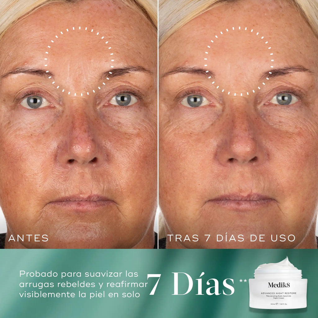 Imagen dividida que muestra los resultados «antes» y «DESPUÉS DE 7 DÍAS DE USO» de un producto para el cuidado de la piel en la frente y la parte superior del rostro de una persona. El lado izquierdo, etiquetado como «ANTES», muestra una textura de la piel notable y algo de enrojecimiento. El lado derecho, etiquetado como «DESPUÉS DE 7 DÍAS DE USO», muestra una piel más suave y con un tono más uniforme. En la esquina inferior derecha se ve un tarro blanco del producto con el texto «7 días».