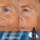 Imagen dividida que muestra los efectos «antes» y «después» de un producto para el cuidado de la piel en el contorno de los ojos de una persona. La parte izquierda, etiquetada como «ANTES», muestra arrugas visibles alrededor de los ojos. La parte derecha, etiquetada como «DESPUÉS de 8 semanas», muestra una reducción significativa en la apariencia de estas arrugas. En la esquina inferior derecha se ve un frasco negro del producto.