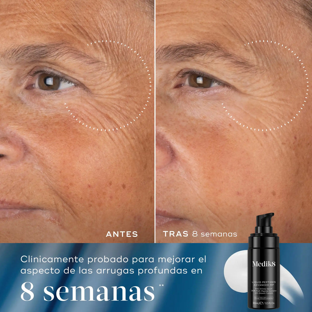Imagen dividida que muestra los efectos «antes» y «después» de un producto para el cuidado de la piel en el contorno de los ojos de una persona. La parte izquierda, etiquetada como «ANTES», muestra arrugas visibles alrededor de los ojos. La parte derecha, etiquetada como «DESPUÉS de 8 semanas», muestra una reducción significativa en la apariencia de estas arrugas. En la esquina inferior derecha se ve un frasco negro del producto.