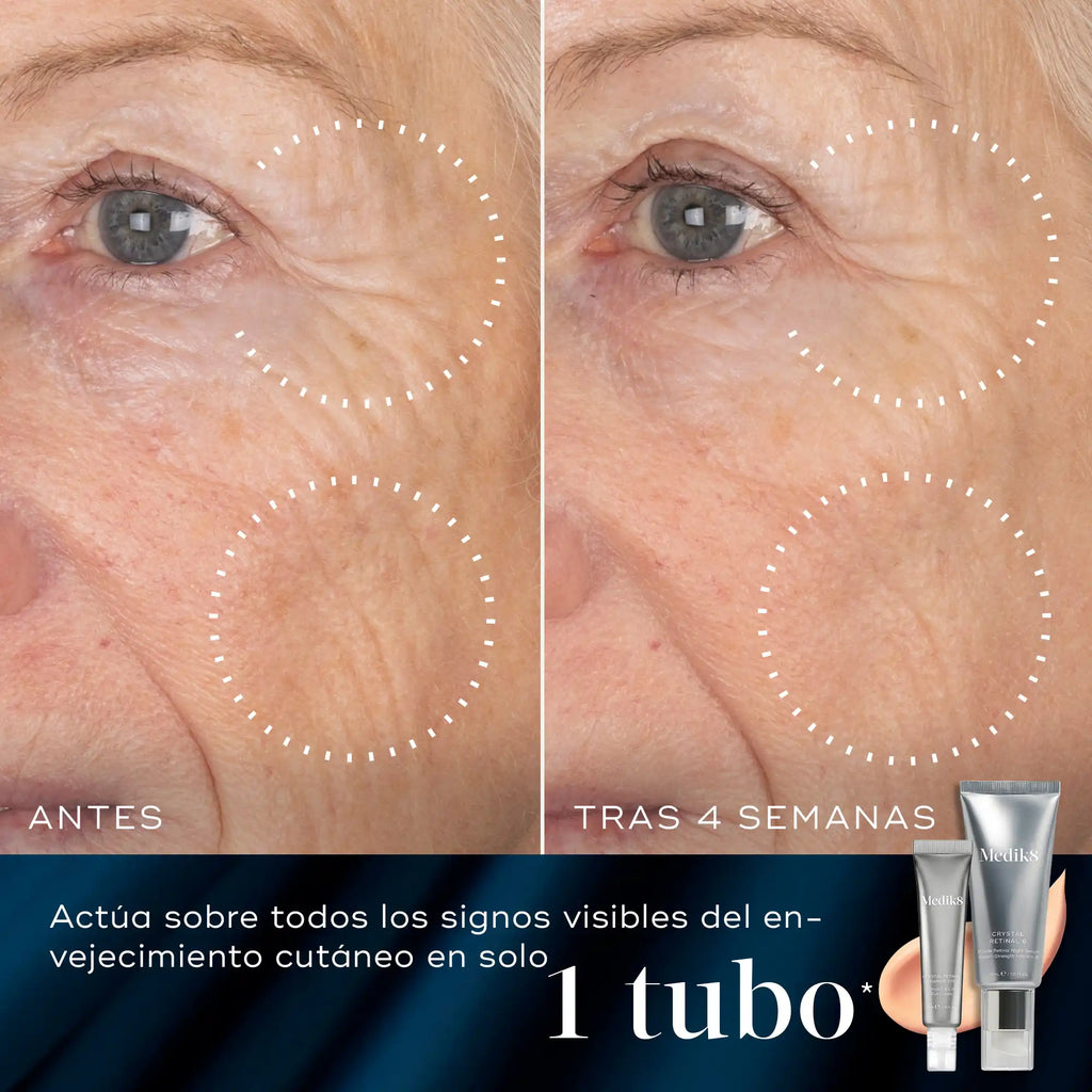 Imagen dividida que muestra los resultados «antes» y «después» de la aplicación de un producto para el cuidado de la piel en el contorno de los ojos de una persona. El lado izquierdo, etiquetado como «ANTES», muestra arrugas y líneas de expresión visibles alrededor de los ojos. El lado derecho, etiquetado como «DESPUÉS DE 4 SEMANAS», muestra una reducción significativa en la apariencia de estas arrugas. En la esquina inferior derecha se ve un pequeño tubo plateado del producto.
