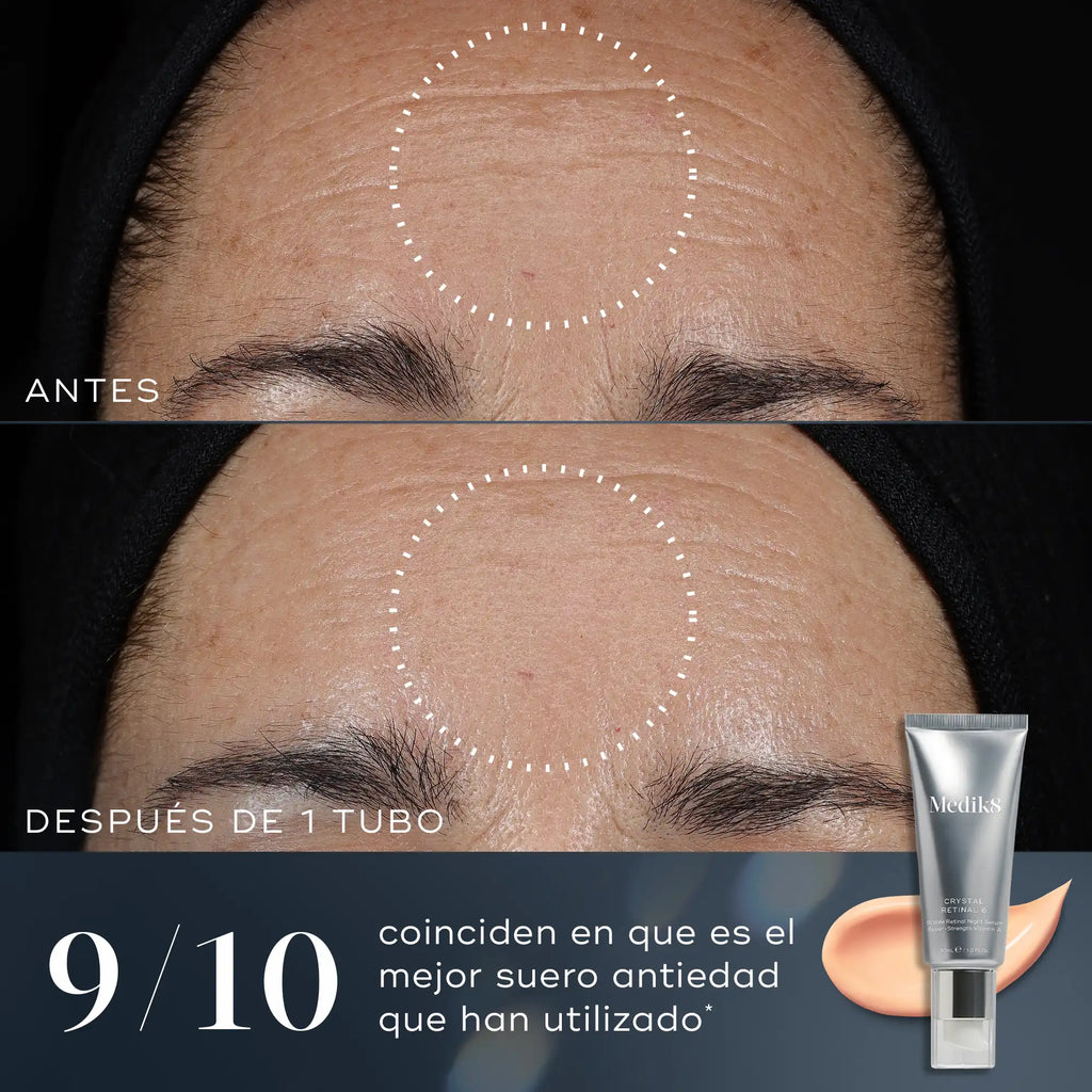 Suero antiedad antes y después de usar Crystal Retinal de Medik8 