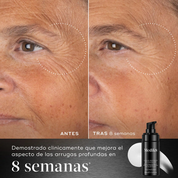 Tras 8 semanas de uso de suero facial Liquid Peptides Advanced de Medik8 se nota una mejora clínica del aspecto de las arrugas-hover-