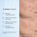 Niacinamide Peptides