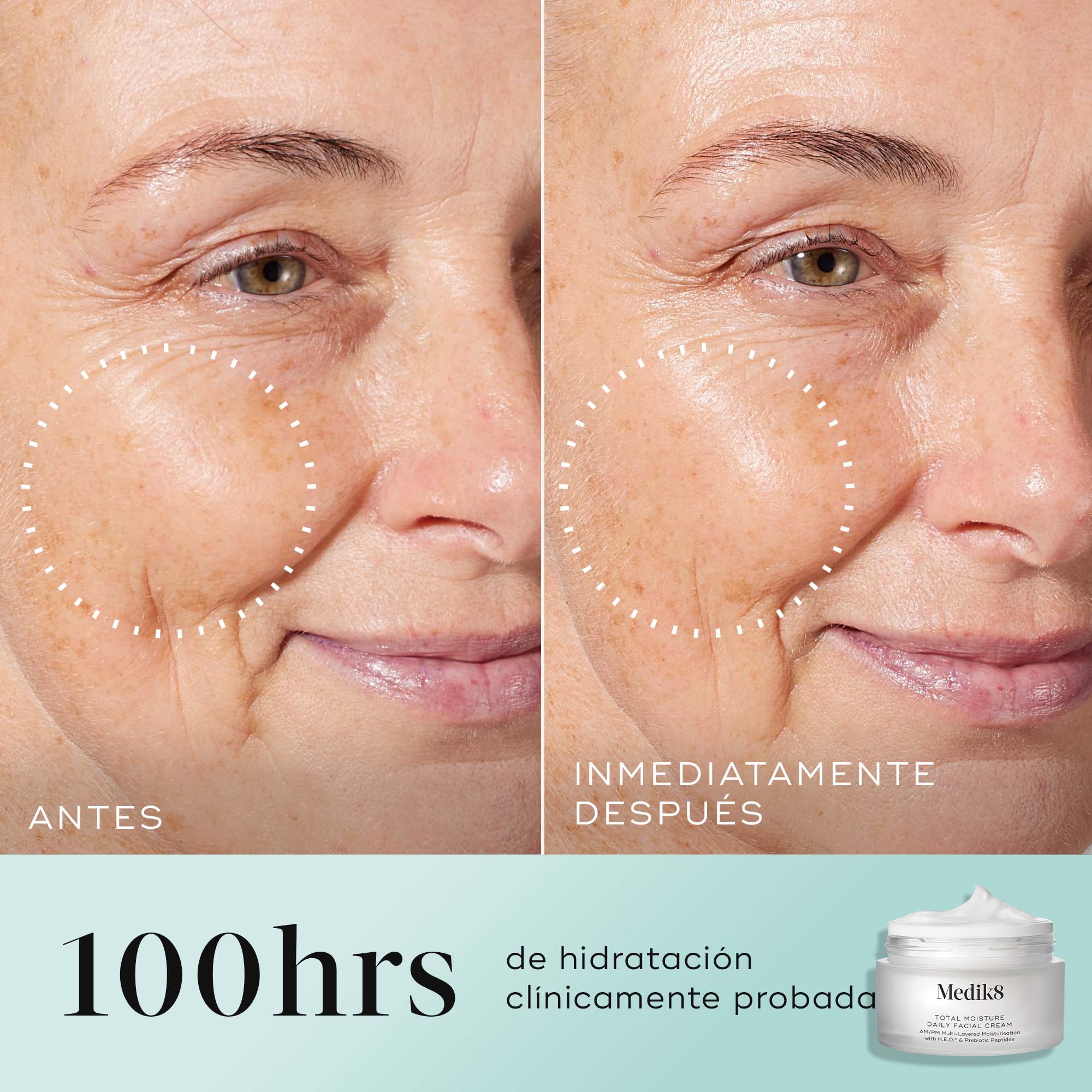 antes y despues Medik8 Total Moisture Daily Facial Cream 