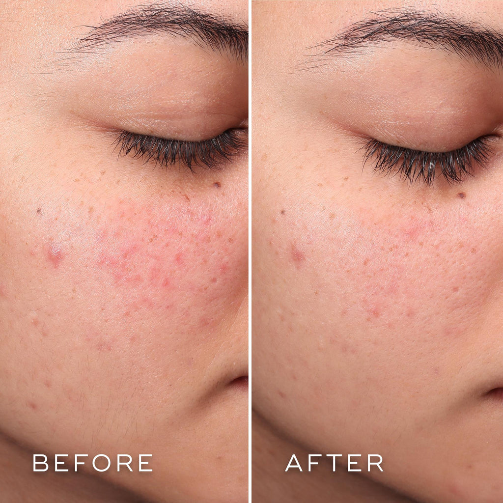 Press & Clear™ Refill la opción sostenible para recargar tu tónico exfoliante